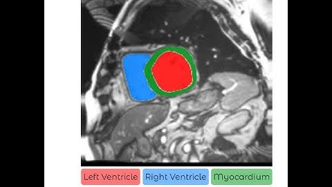 Cardiac MRI Segmentation of Ventricular Structures and Myocardium Using U-Net Variants
