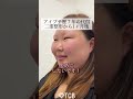 【二重整形】アイプチ歴7年の代償？！#shorts #二重整形 #二重埋没 #末広二重 #目頭切開 #ダウンタイム #蒙古襞 #まぶた重い ＃腫れ #アイプチ #TCB