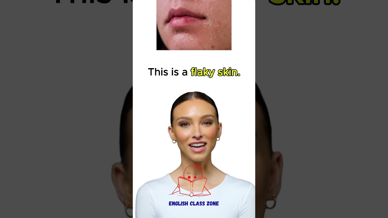 Don't always say "Bad Skin" use the right words instead!