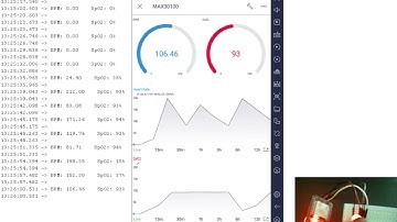 Health Monitoring System using Esp32 & Blynk App