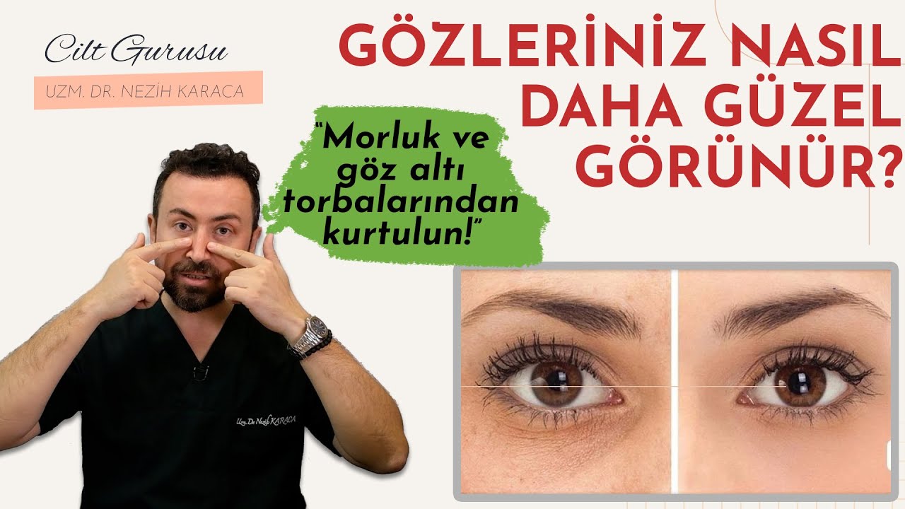 Göz Çevresi Problemlerinin Çözümü: Gözaltı Morluğu, Kırışıklık, Torbalanma ve Kaşlarda Düşme