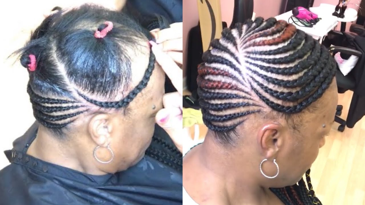 Traction Alopecia How to Reverse It Causes and Treatment  Hairverse