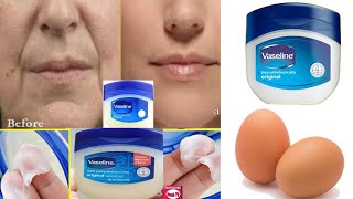 Remove Wrinkles From Face Naturally at Home / Get Rid of Deep Mouth Wrinkles using Vaseline and Egg screenshot 5