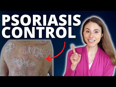 Video: 4 sätt att behandla psoriasis i ansiktet