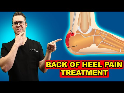 Foot Fat Pad Atrophy & Augmentation [Causes & Best Home Treatment]