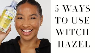 5 Ways to Use Witch Hazel | Witch Hazel Skincare + Acne Benefits