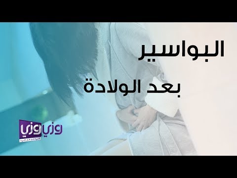 فيديو: كيفية علاج البواسير بعد الحمل: 15 خطوة (بالصور)