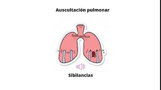 Ruidos respiratorios agregados - Sibilancias