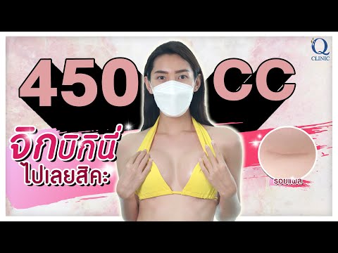 เสริมหน้าอก 450cc จิกบิกินี่ไปเลยสิคะ