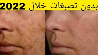 الانطلاقة الرسمية لبرامج علاج التصبغات الجلدية ومنتوجات للعلاج بلا رجعة/الجزء3