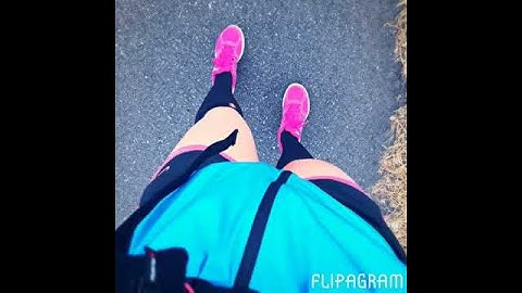 Dexcom continuous glucose monitor trial