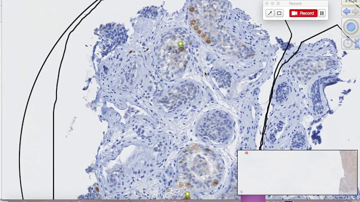 Digital Pathology Counting