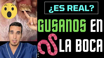 ¿Cuánto tiempo se puede vivir con gusanos?