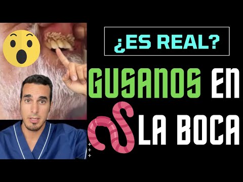 Video: ¿Puedes ahogar a los gusanos de alambre?