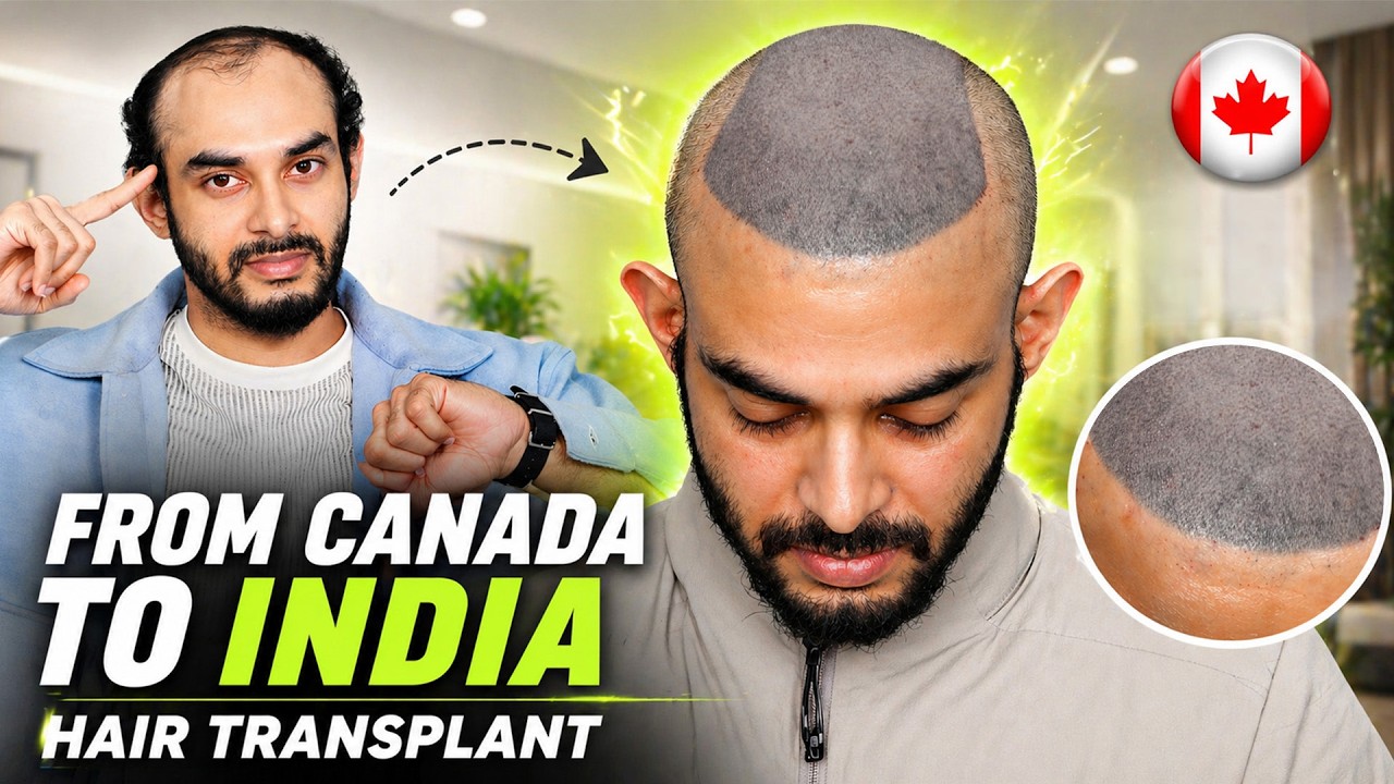 Hair Transplant Procedure and Process