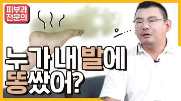 발냄새 없애는 방법, 이 영상 하나면 고민 끝! (발냄새 원인, 세균, 땀 제거방법)