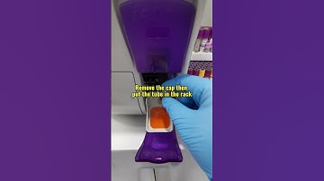 Complete blood count #blood #laboratory #mls #cls #medtechstudent