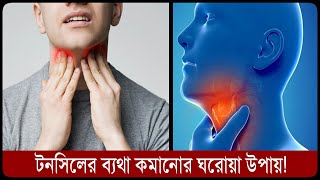 মাত্র ১ দিনেই  টনসিলের ব্যথা দূর করার ঘরোয়া উপায় ।।