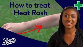 How to treat heat rash | Meet Our Pharmacy Team | Boots UK