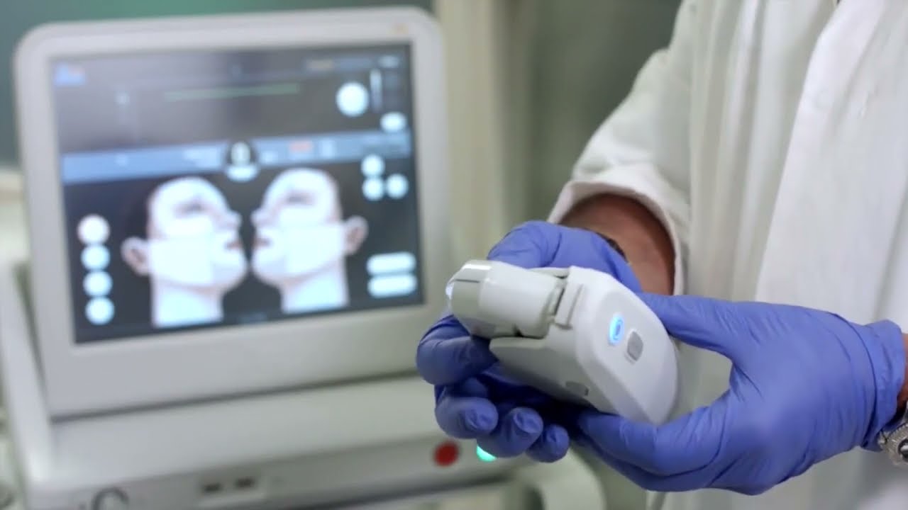 L'Ultherapy - Lifting sans chirurgie grâce aux ultrasons