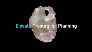 Enhance Surgical Planning with the J5 Digital Anatomy 3D Printer