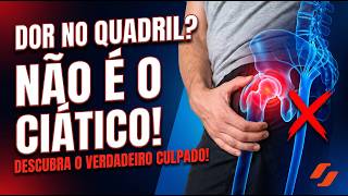 DOR NO QUADRIL? NÃO É O CIÁTICO!
