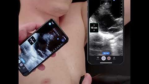 Ultrasound Education: Cardiac Image Optimization