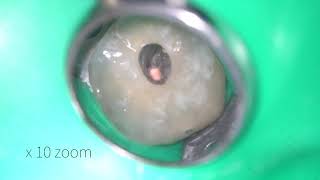 Carl Zeiss Omni Pico Levels of Magnification