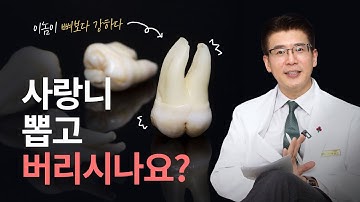 치아이식에 사랑니를 사용한다? 냉장고에 보관하면 될까요???