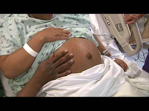 dropping-baby-weight-between-pregnancies-can-decrease-gestational-diabetes-risk