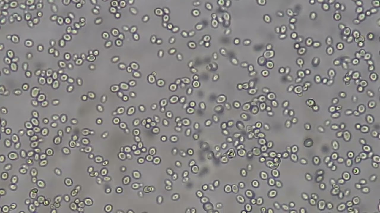 Yeast cells in wet moount of culture microscopy