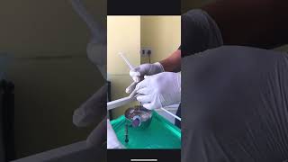 #hairtransplant #hairrestoration #pune call us on : 9822449044