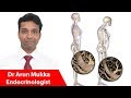 Osteoporosis and Diabetes - Symptoms, Diagnosis &amp; Treatment | Dr Arun Mukka #Endocrinologist