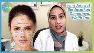 Jenis Jerawat dan Cara Mengatasinya | Skincare101
