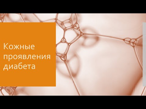 Диабет 12. Кожные проявления диабета