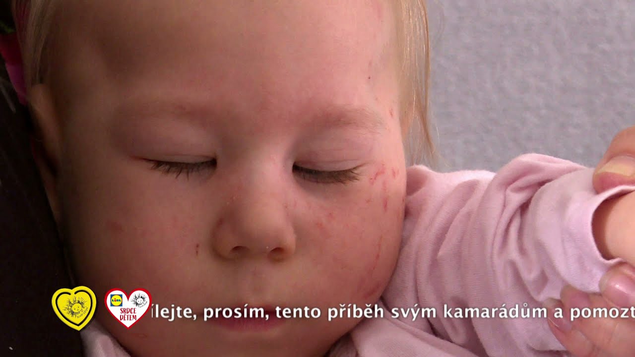 Klárka, 2 roky, Srdce dětem