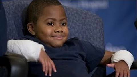 Incredible story of first boy to get double hand transplant - DayDayNews