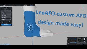 LeoAFO: Revolutionizing Custom AFO Design