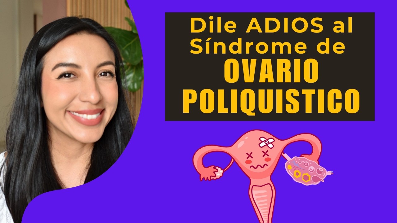 SÍNDROME de OVARIO POLIQUÍSTICO: así se CURA