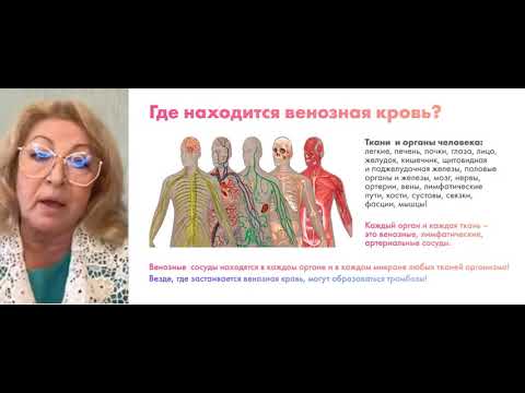 Видео: Защо се нуждаете от ултразвук на кръвоносни съдове