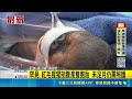 紅毛猩猩懷雙胞胎 北市動物園剖腹產迎新生命 罕見 紅毛猩猩剖腹產雙胞胎 未足月仍需照護｜三立新聞LIVE