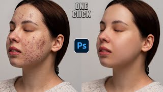 One Click Remove anything from Your Picture!