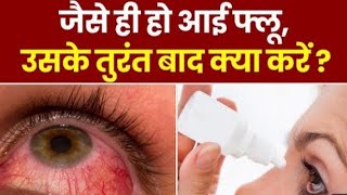 Eye Flu- kaise hota hai आई फ्लू होने के बाद तुरंत क्या करें । Conjunctivitis