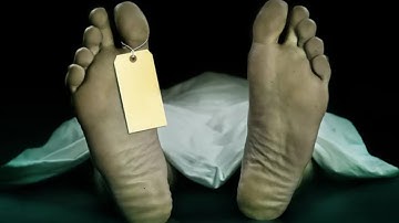 Things About Embalming Your Funeral Director Won