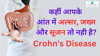 कहीं आपके आंत में अल्सर, ज﻿ख्म और सूजन तो नही है | Crohn’s Disease (in Hindi) |