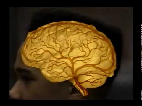 Cocaine and the Brain, The Holman Archives Video, Radiology Department