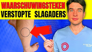 “6 Verborgen Tekenen van Verstopte Slagaders Die Je Niet Mag Negeren | Cardioloog Legt Uit