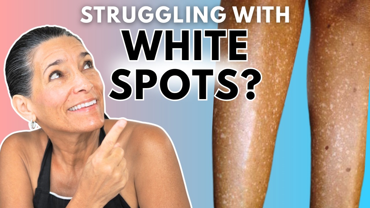White Spots on Your Skin? Here's Why They Appear And How You Can Remove ...