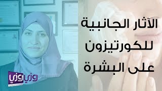 الآثار الجانبية للكورتيزون على الجلد والوجه