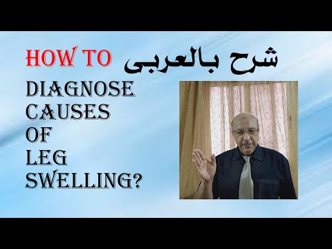 How to diagnose causes of leg swelling ?شرح بالعربى